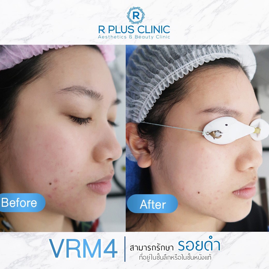 Review – R Plus Clinic
